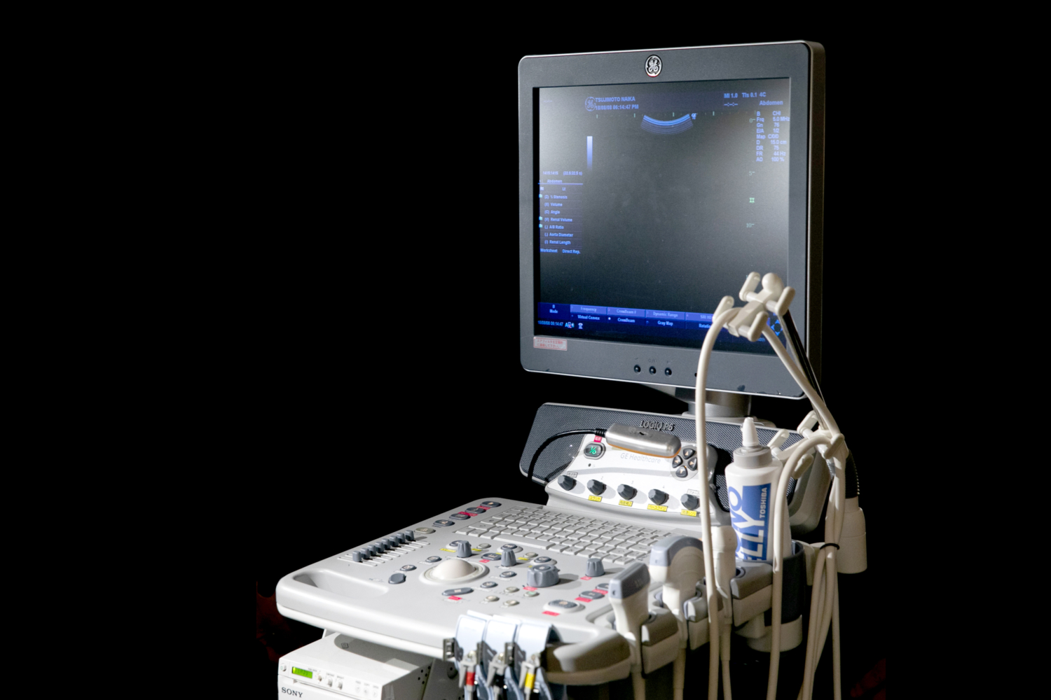 超音波画像診断装置（エコー） | 辻本内科医院｜奈良県橿原市 近鉄大和